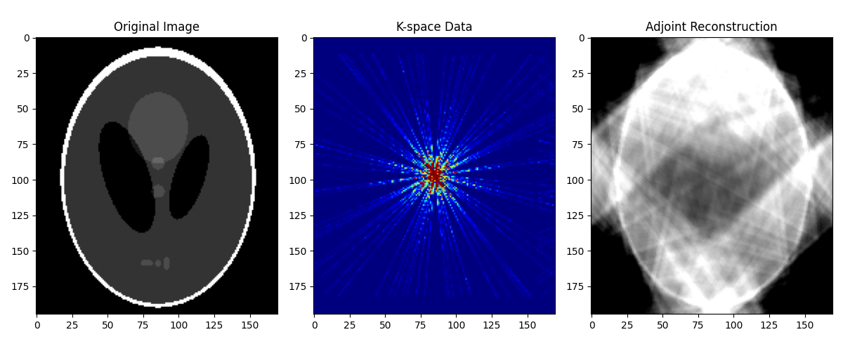 Original Image, K-space Data, Adjoint Reconstruction